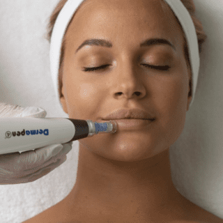 dermapen microneedling EC4