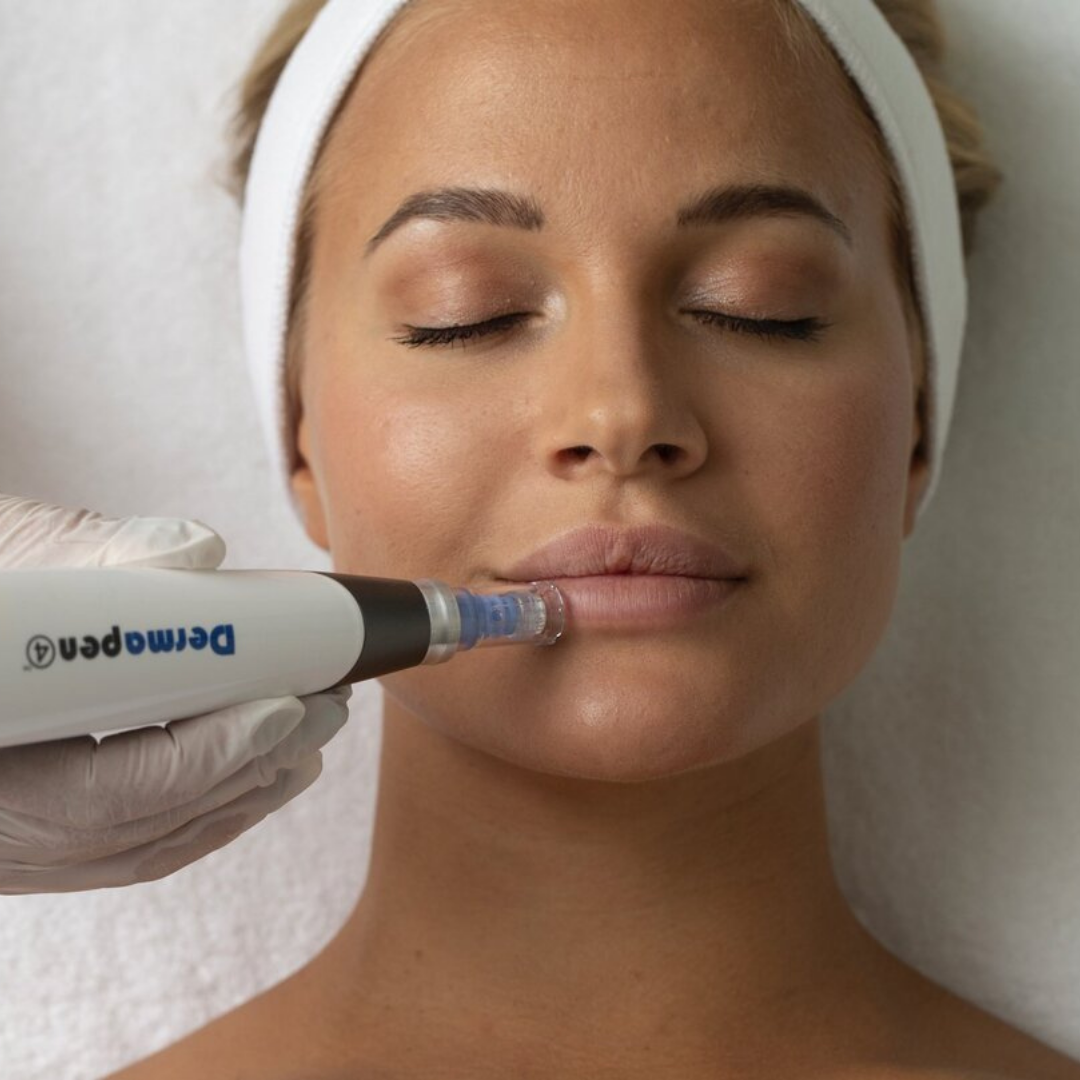 Dermapen Microneedling Image