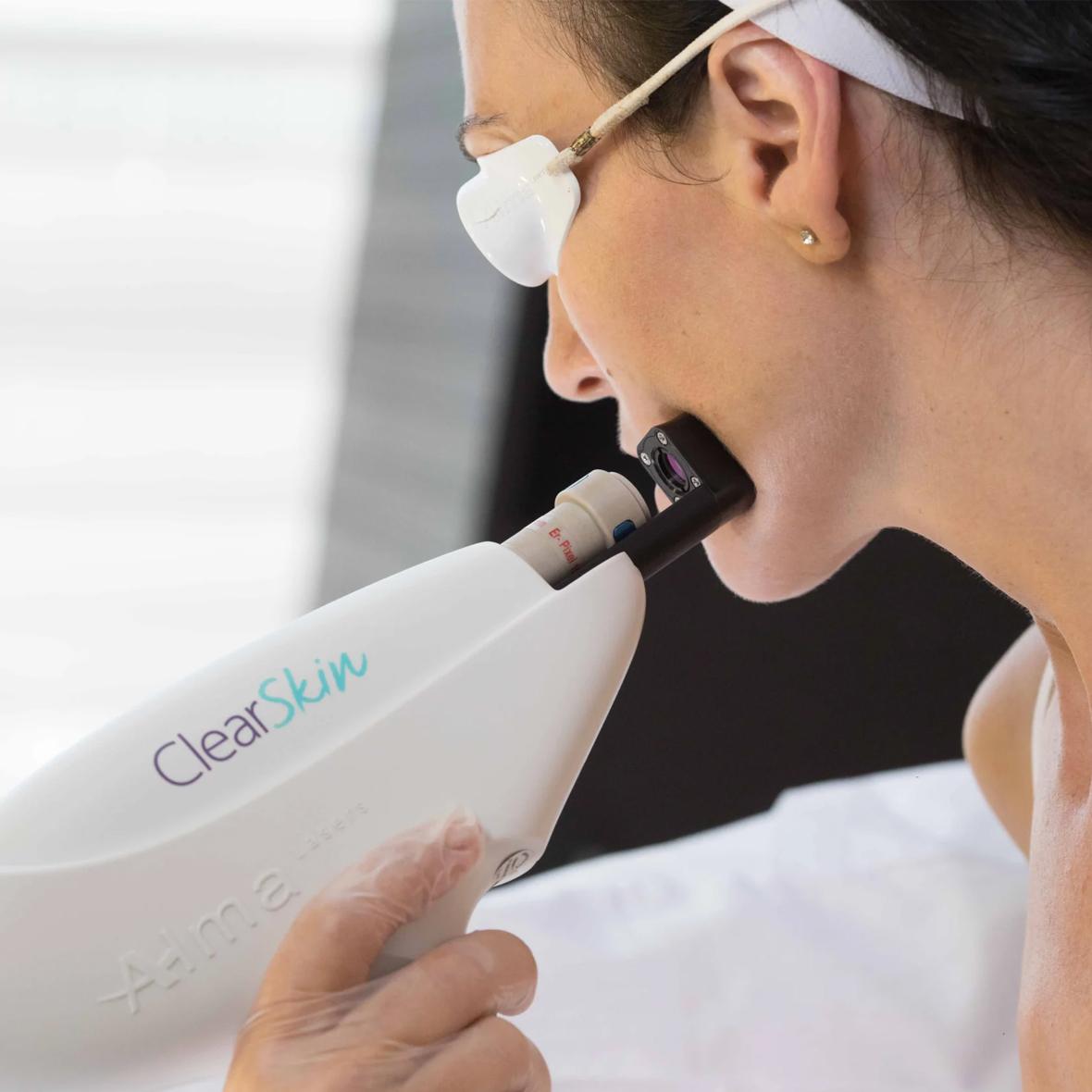 ClearSkin Treatment Image
