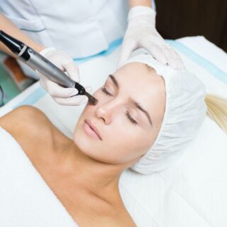 EC4 Microneedling