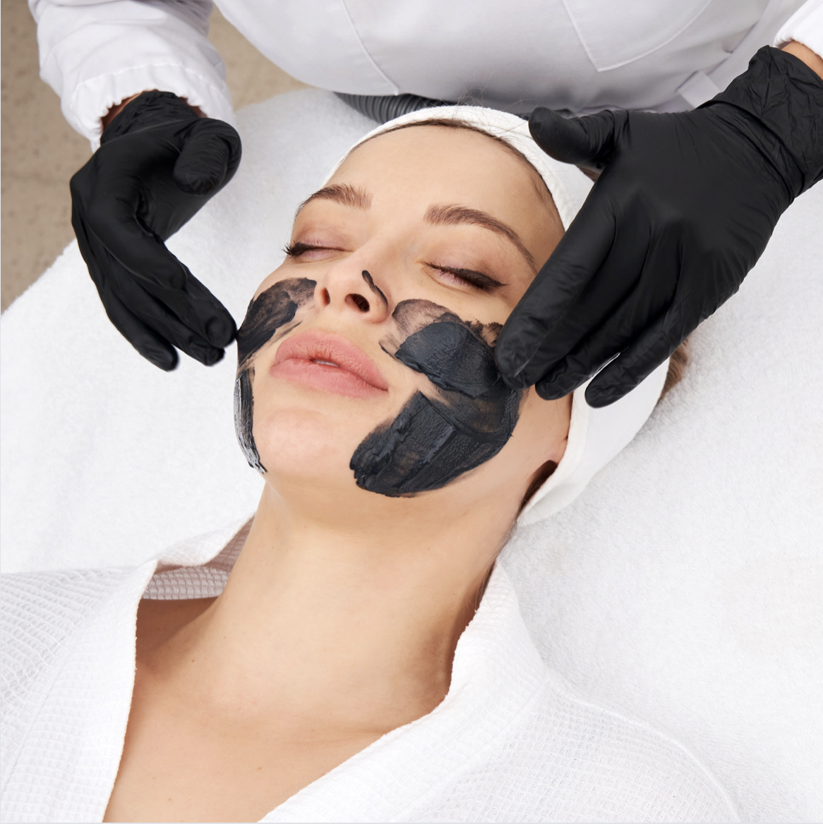 Carbon Laser Facial Treatment Image
