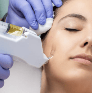 MESOTHERAPHY clinic EC4