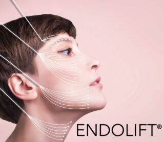 Endolift London