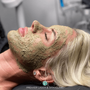 Herbal Green Peel