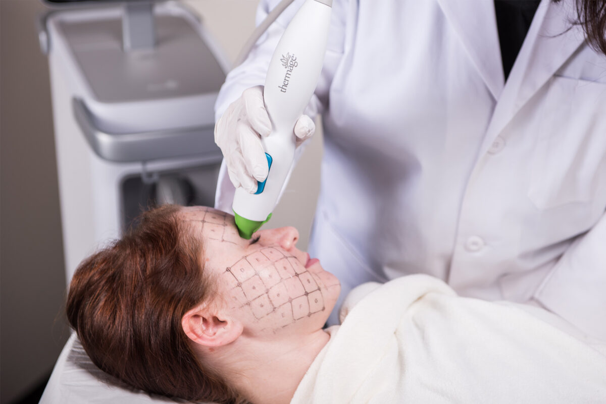 Thermage treatment