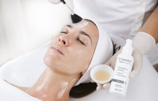 chemical peels london