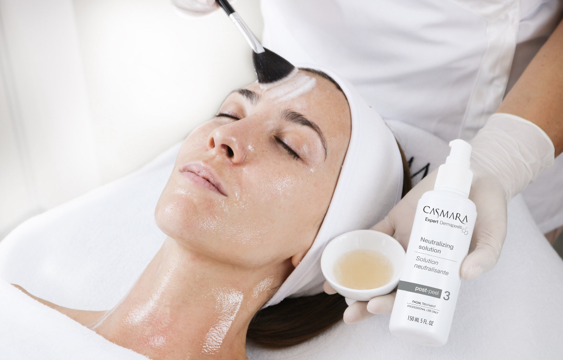 Casmara Chemical Peels Image