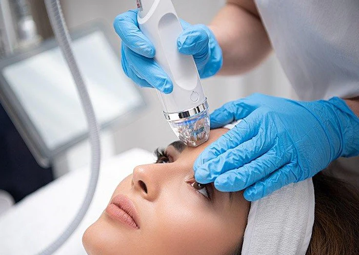 microneedling vs rf microneedling