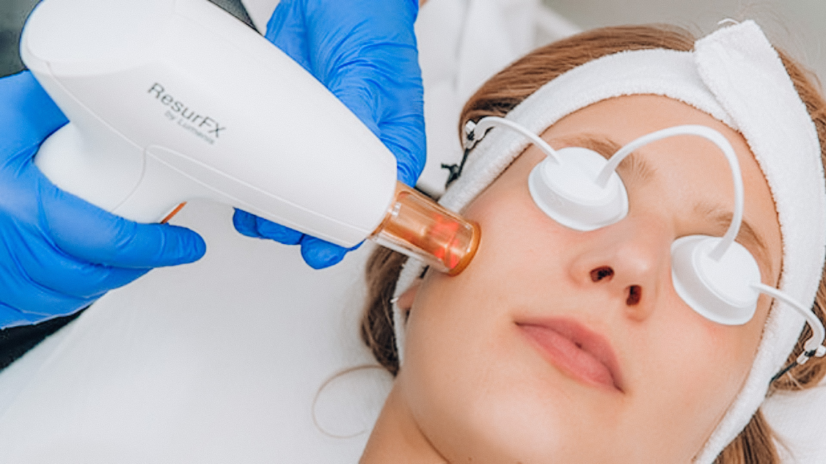 Laser Skin Resurfacing - ResurFX™ Image