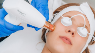 laser skin resurfacing london