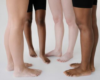 spider vein removal london