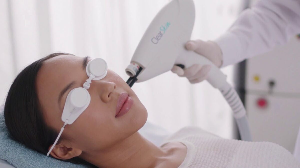 Clearskin london