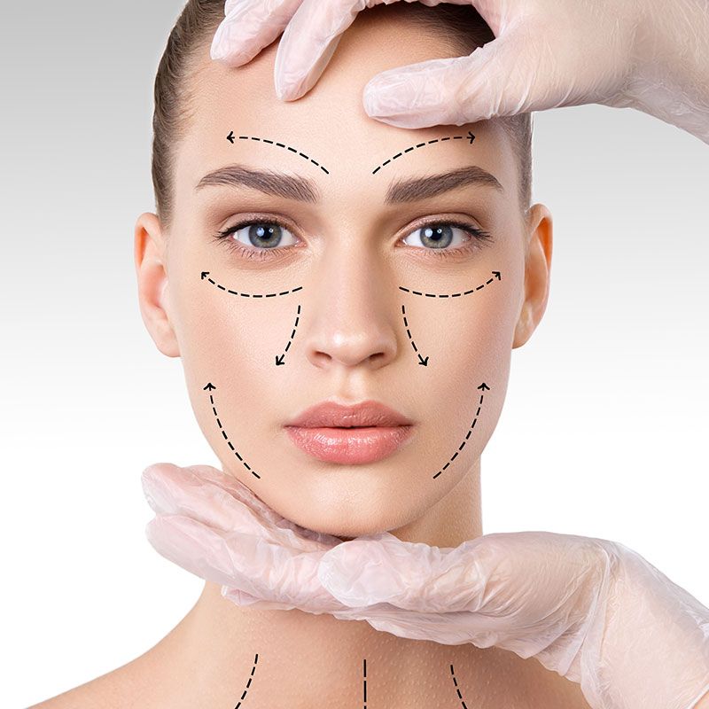 Brow Lift Image