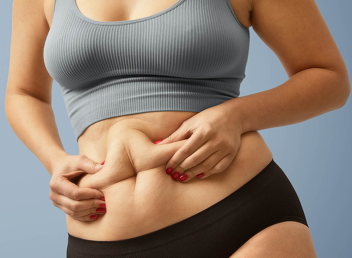 woman,body,fat,belly.,obese,woman,hands,holding,excessive,tummy