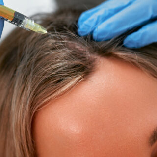 mobile banner hair growth for women