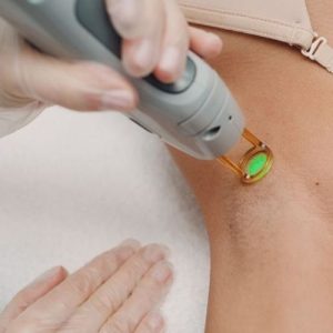 laser hair removal upper body packages