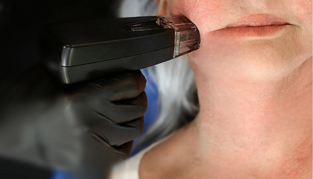 How Long Does It Take to See Results from Morpheus8?