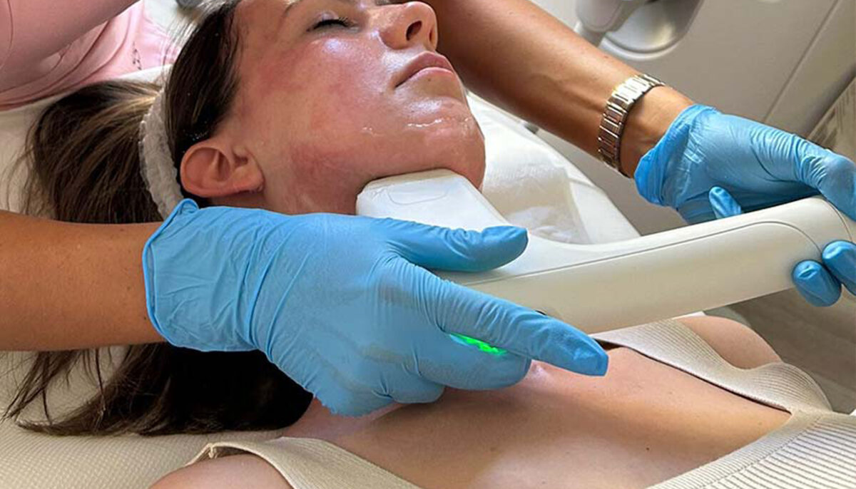 Long-Term Anti-Ageing with Sofwave