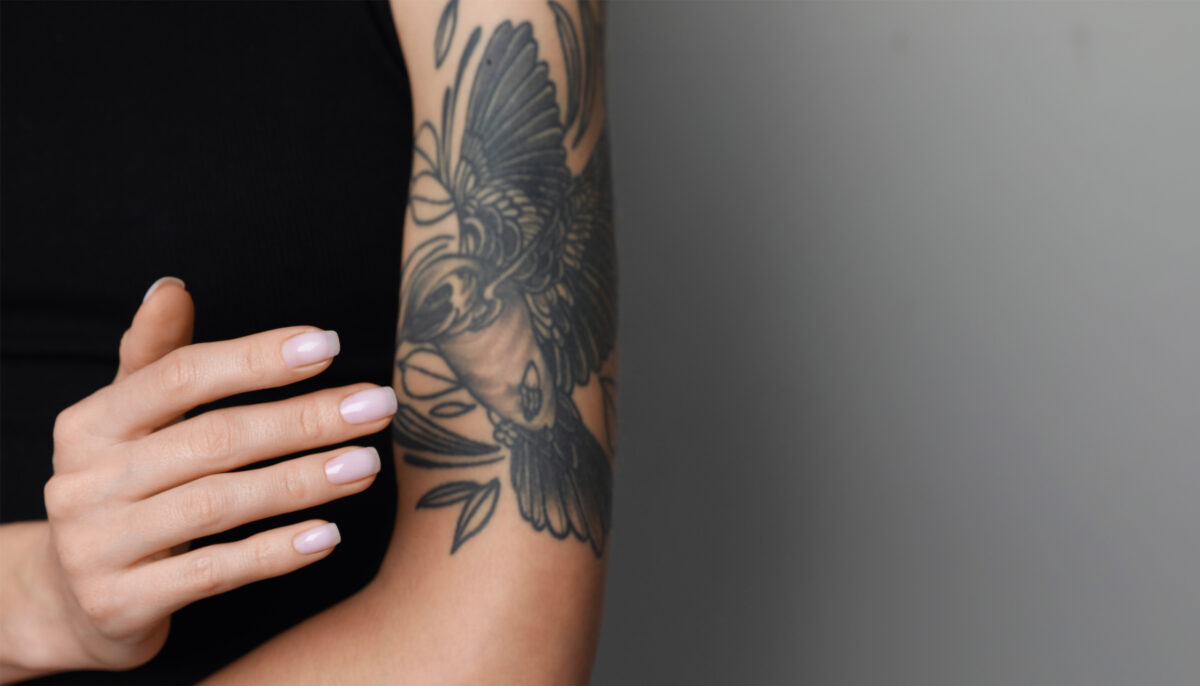 Are Older Tattoos Easier to Remove?