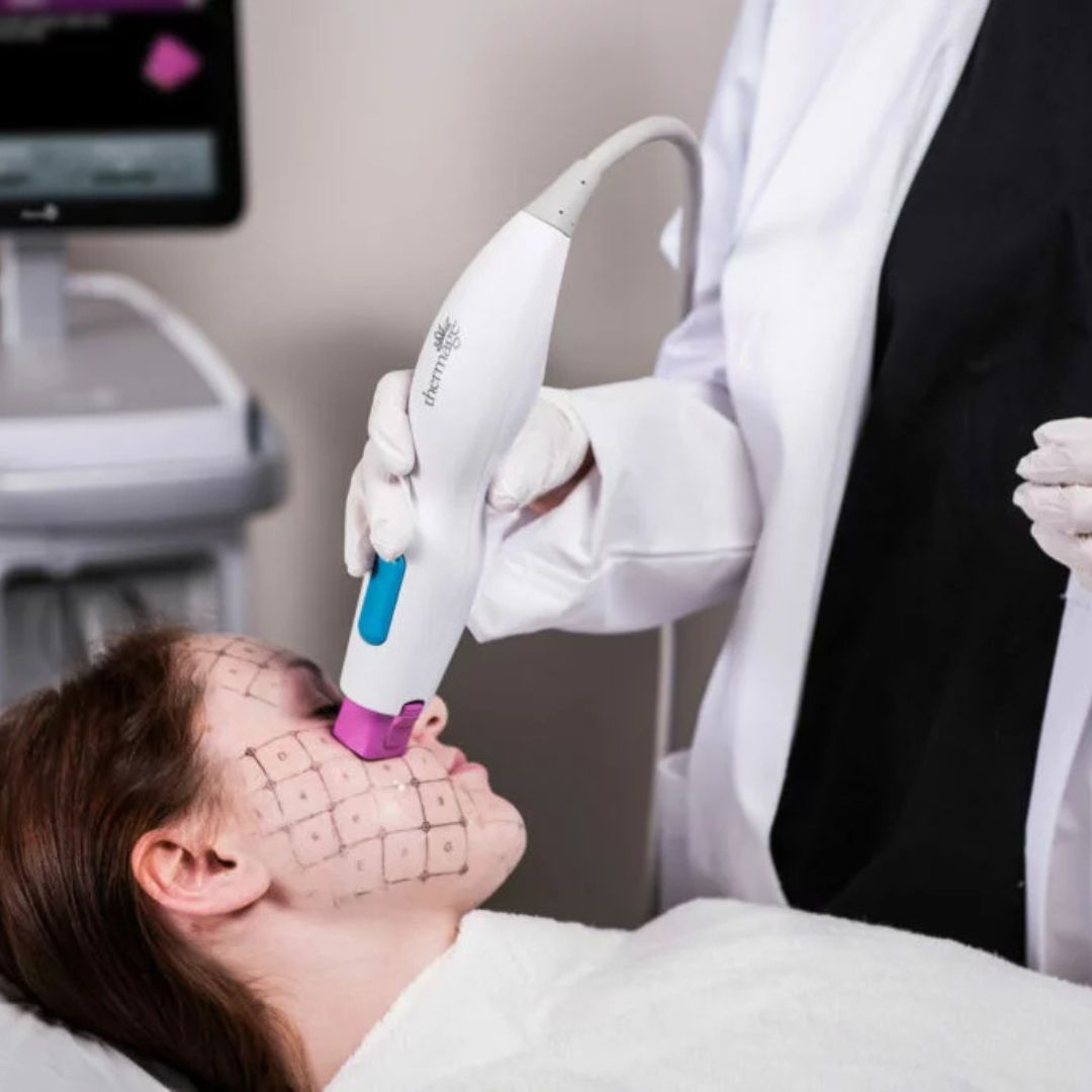 The Best Non-Surgical Face Lift Treatments in London: